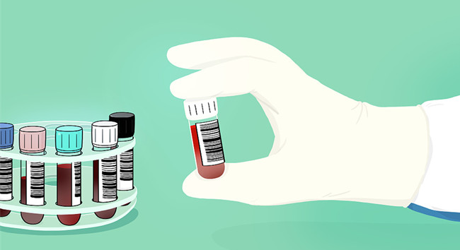 1595554213693878.jpg 進口胎牛血清關